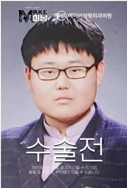 image 100